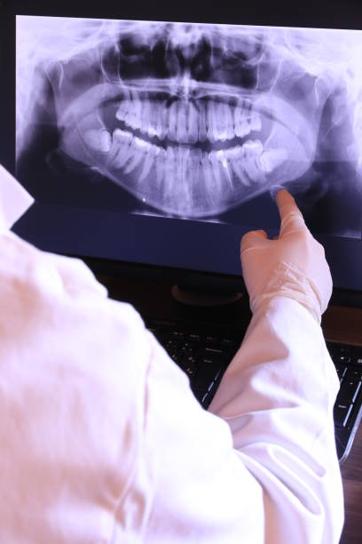 Best Emergency Root Canal Therapy in Rancho Murieta, CA