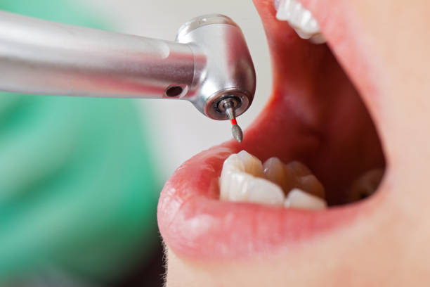 Best Emergency Pediatric Dental Care in Rancho Murieta, CA